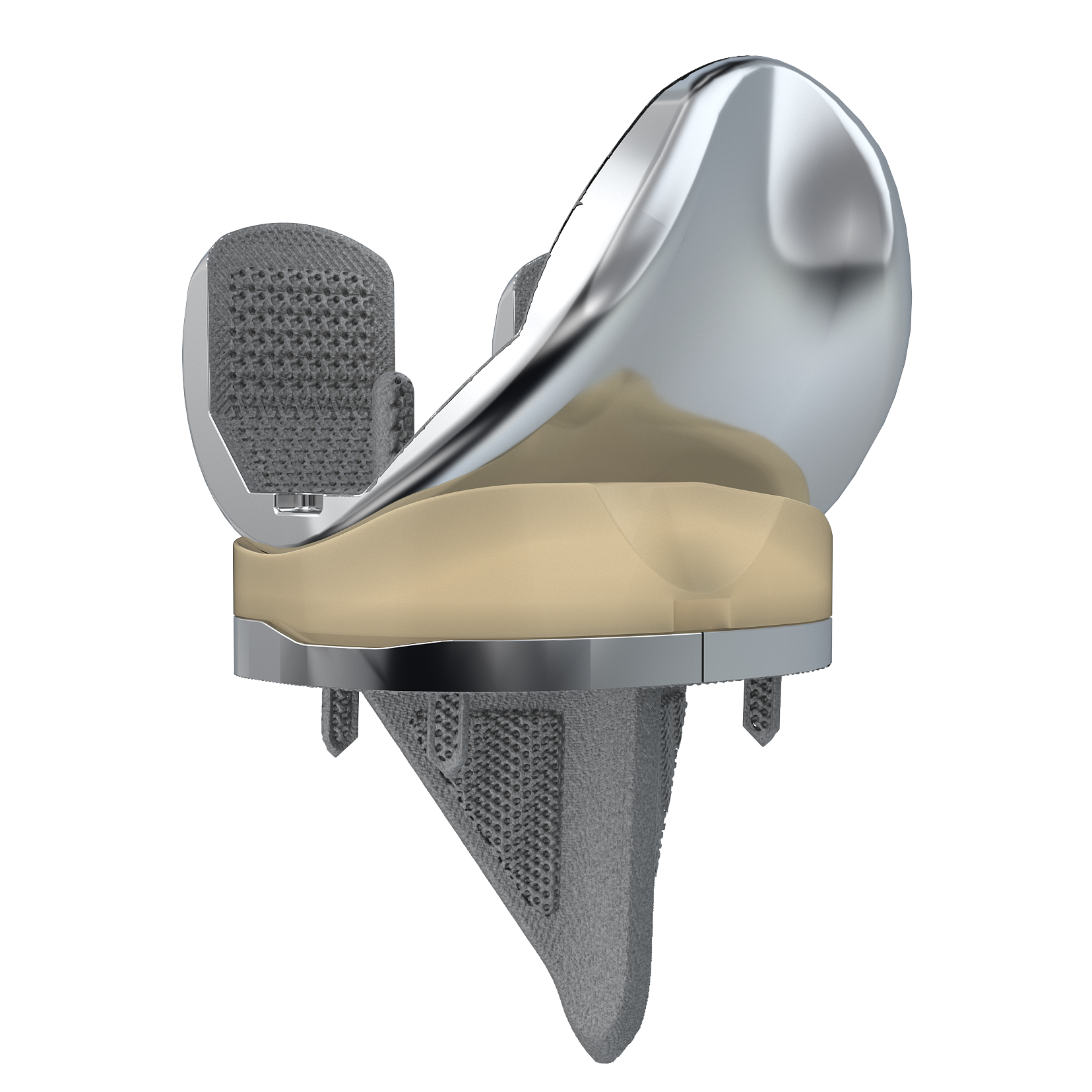 CONCOR - Uncemented Medial Pivot Knee Implant